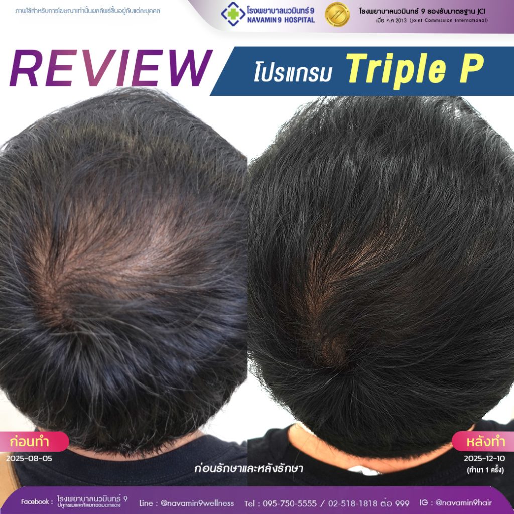 นวมินทร์9-โปรเเกรมprp-ชาย-01-02:03