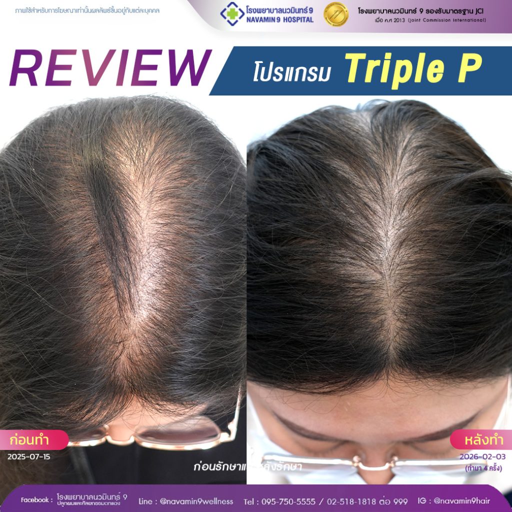 นวมินทร์9-โปรเเกรมprp-หญิง-02-02:03