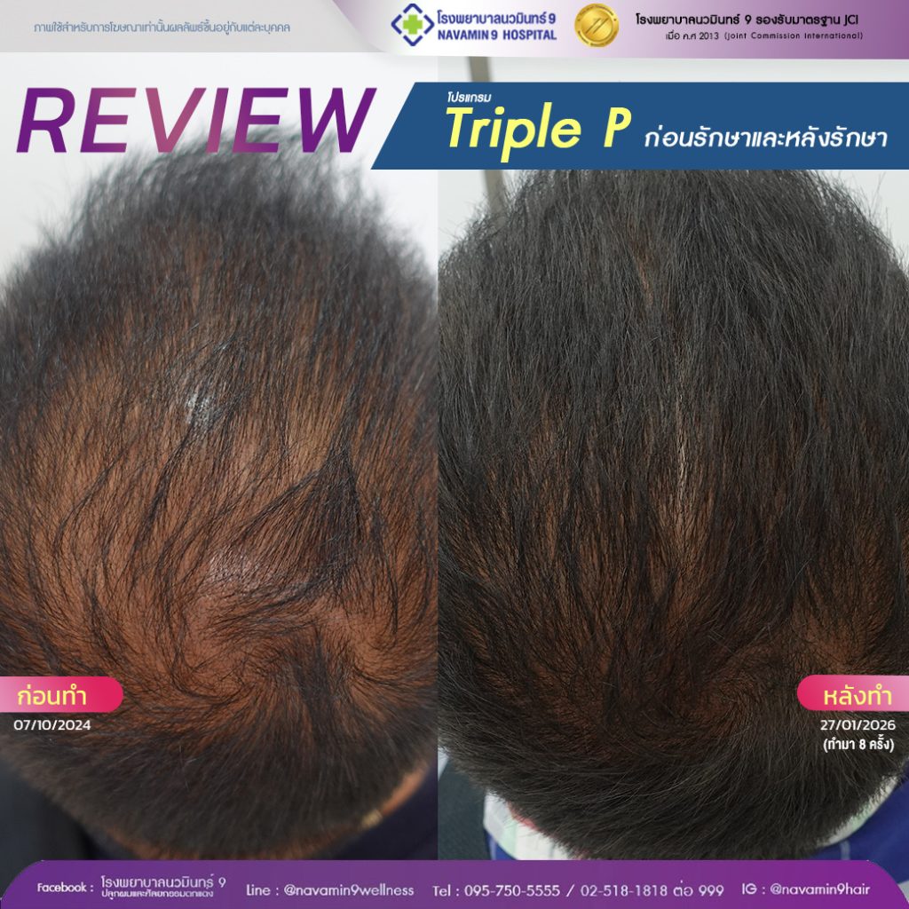 นวมินทร์9-โปรเเกรมprp-ชาย-19-27-01