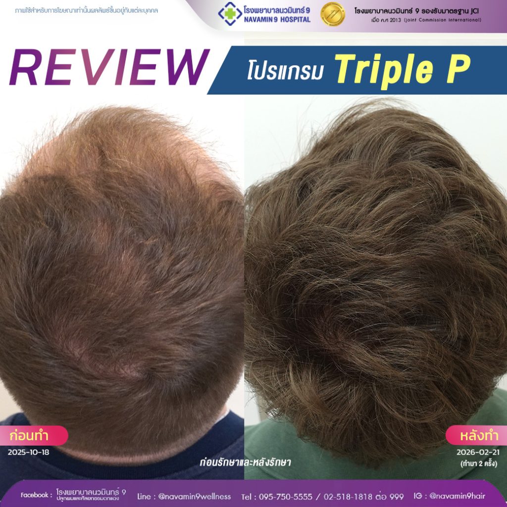 นวมินทร์9-โปรเเกรม-prp-ชาย-33-2:21