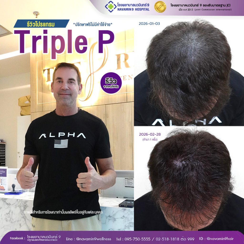 นวมินทร์9-โปรเเกรม-ชาย-prp-36-2:28